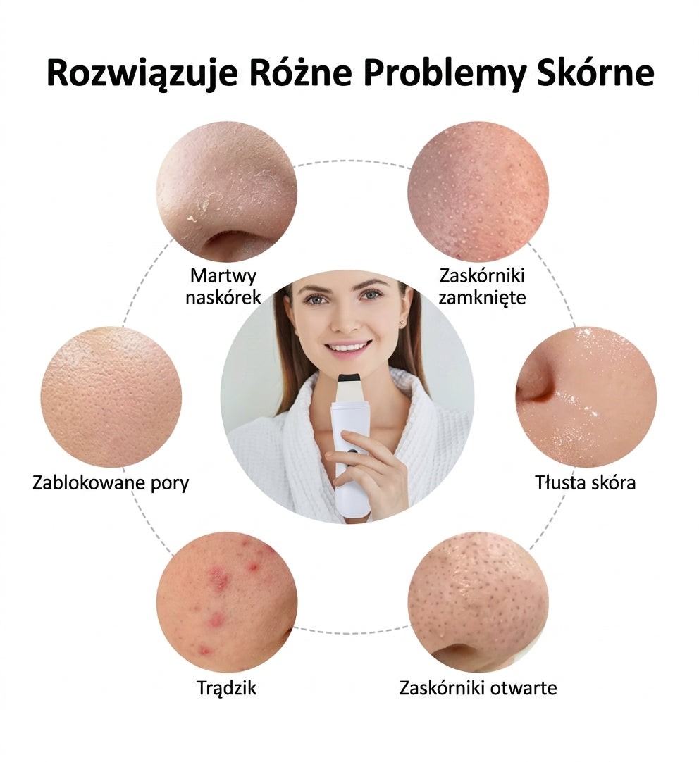 Ultradźwiękowy skrobak do twarzy – CZYSTA SKÓRA BEZ ZASKÓRNIKÓW!