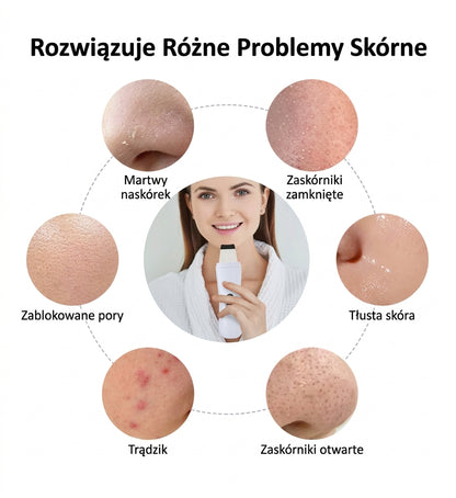 Ultradźwiękowy skrobak do twarzy – CZYSTA SKÓRA BEZ ZASKÓRNIKÓW!